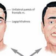 Illustration for article titled Cara Minum Obat Stroke De Nature